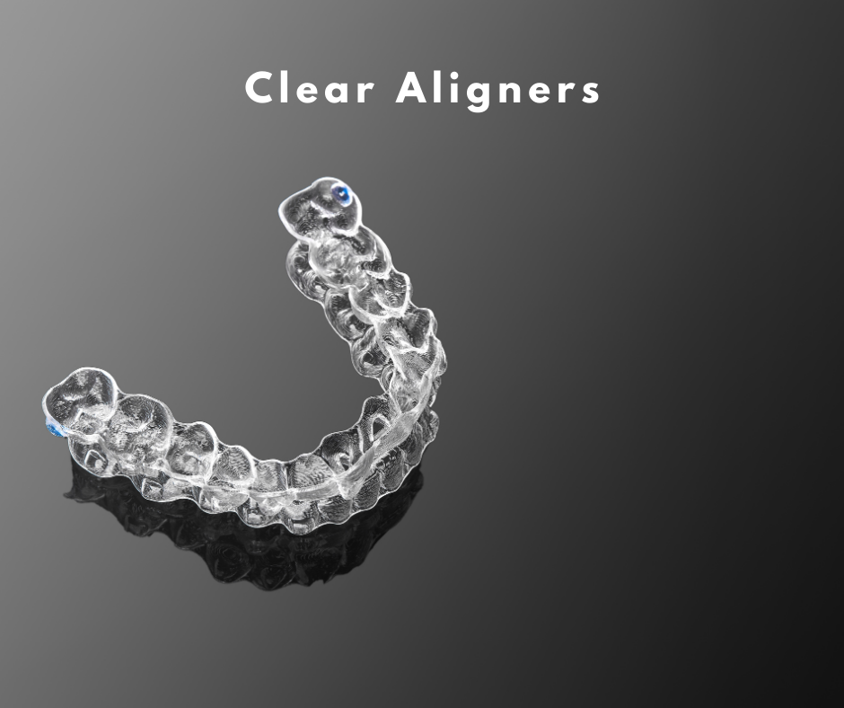 aligner