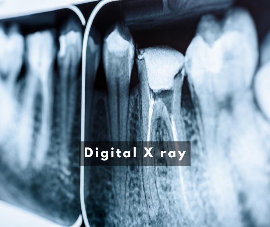 xray